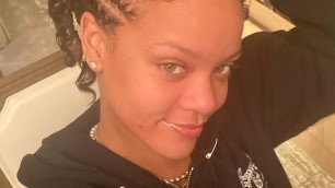 'Rihanna FREES the Pimple in New Makeup-Free Selfie'