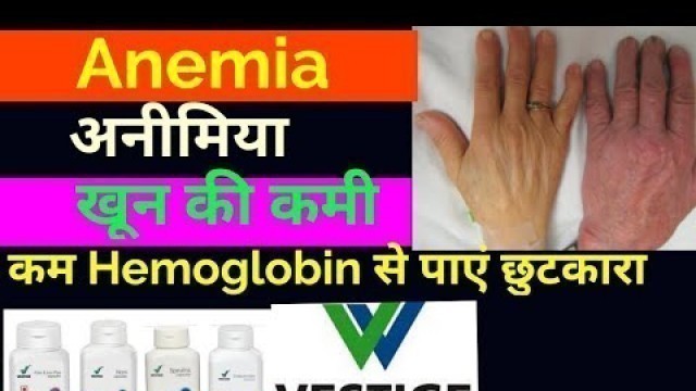 'Vestige products for Anemia। Vestime products for increase hemoglobin। Anemia treatment in Hindi'