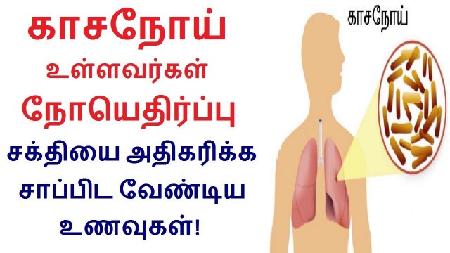 'Foods to boost immunity of tuberculosis patients in Tamil | Rahul  Health Tips in Tamil'