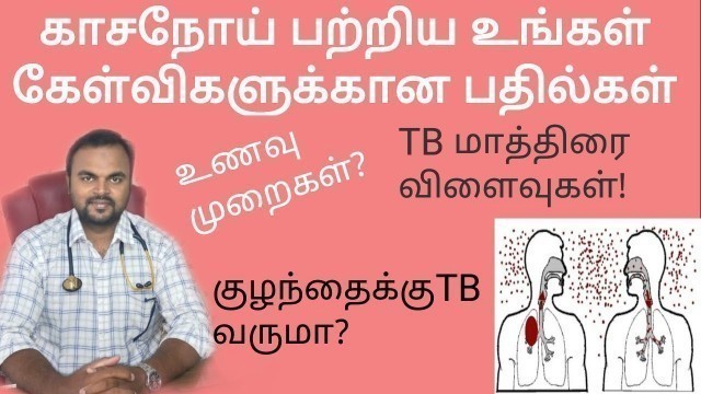 'Q and A about TB/Food habits for Tb/Tb during pregnancy/ precautions for Tb/Tb tablets side effects'