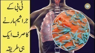 'Tuberculosis | TB Symptoms, precautions, Food, preventions |TB ka Ilaj in Urdu Hindi | Kill TB germs'